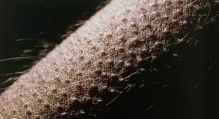 Do you have goosebumps in hot weather? Here's why it could be dangerous