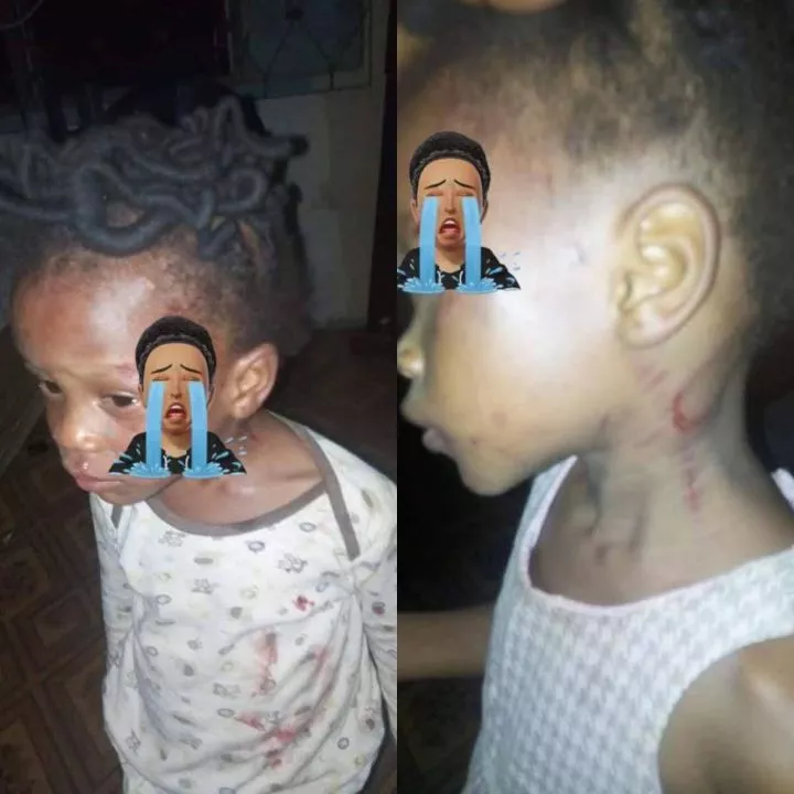 Girl left with welts after her mother allegedly beat her for not knowing how to count in Ondo state (photos)