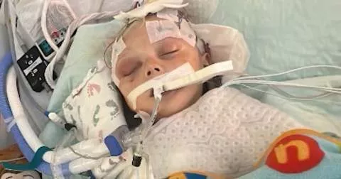 2 year old Child fighting for life after being mercilessly be@ten by mother