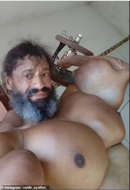 Valdir Segato, the Brazilian Hulk TikTok star who injected himself with life-threatening oil to create a 23-inch bicep, dies on his 55th birthday