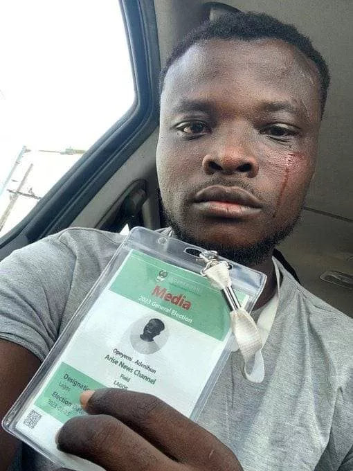 Journalist injured by thugs at Elegushi Palace