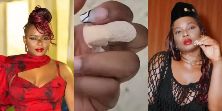 "I only lost a nail" - Yemi Alade says as she survives car accident in Spain (Video)