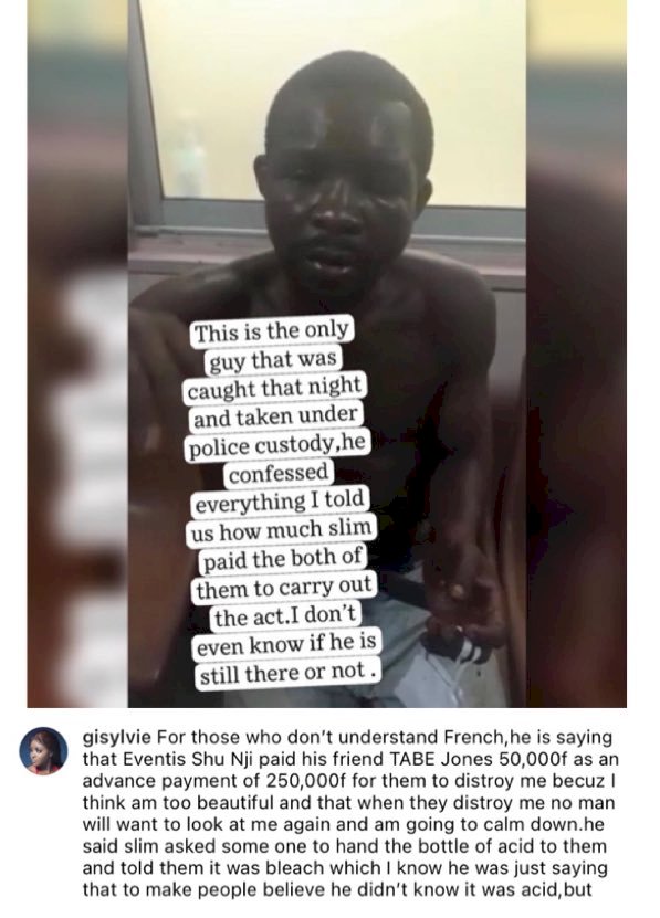 Lady narrates how an envious neighbour paid individuals to pour acid on her