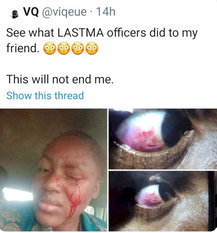 Woman bleeds from the eye after a LASTMA official allegedly assaulted her