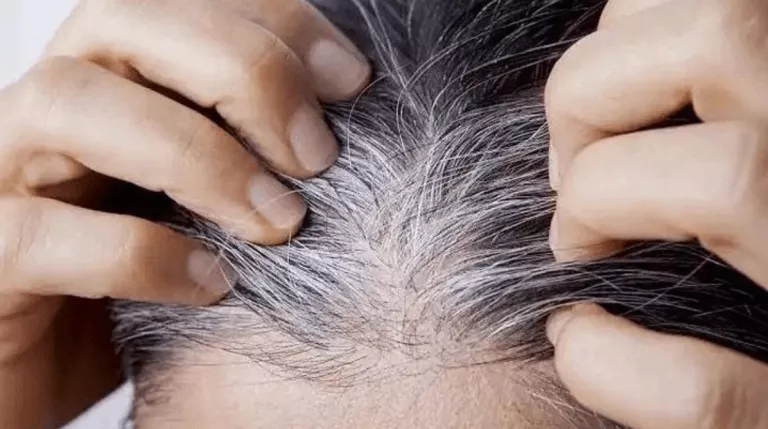 What Causes White Hair To Appear At A Young Age?