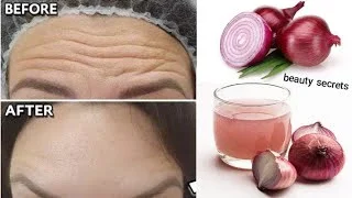 Reasons Why Men and Women Should Rub Onions on Their Face