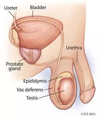 How much do you know about testicular cancer