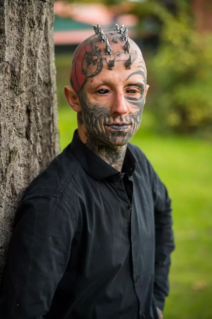 Man working on becoming reptilian by getting silicone inserted weekly in his skull