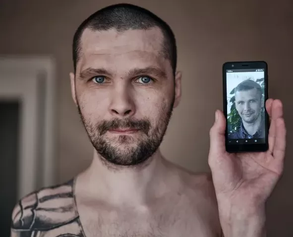 Before and after photos of tortured Ukrainian war prisoners who lost up to 40kg body weight during 2-year Russian captivity