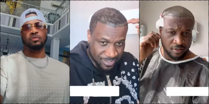 Peter Okoye undergoes hair transplant in Turkey