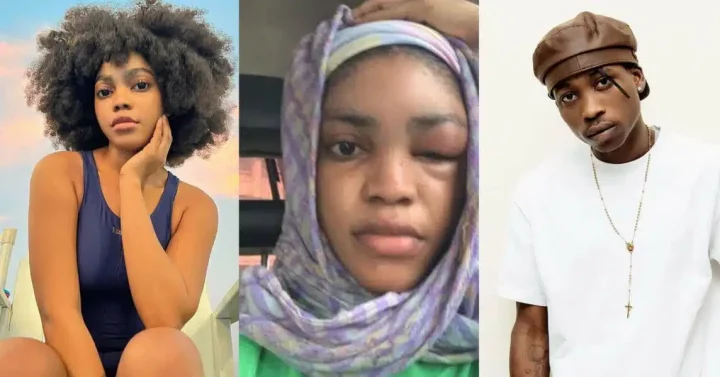 'He's lying; it wasn't an allergy; he begged me countless times to come back' - Lil Frosh's ex girlfriend