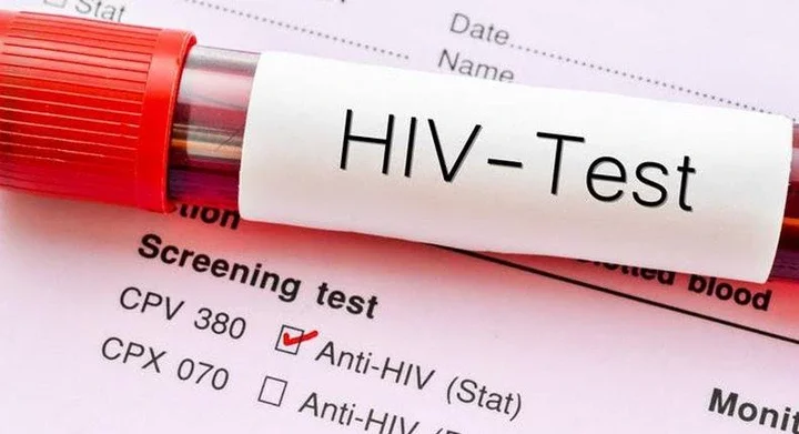  HIV tests