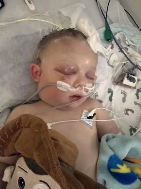 2 year old Child fighting for life after being mercilessly be@ten by mother