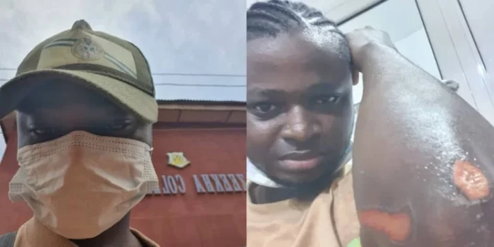 Corps member laments as NYSC serves him query for failing to report to PPA after accident