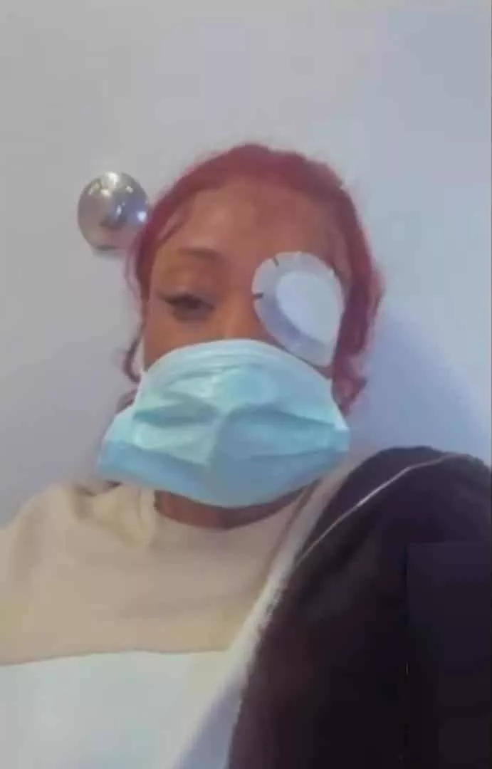 Lady almost loses an eye after fixing eyelash extension (Video)