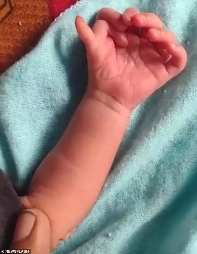 Baby born with 14 fingers and 12 toes is hailed as the incarnation of a Hindu goddess in India