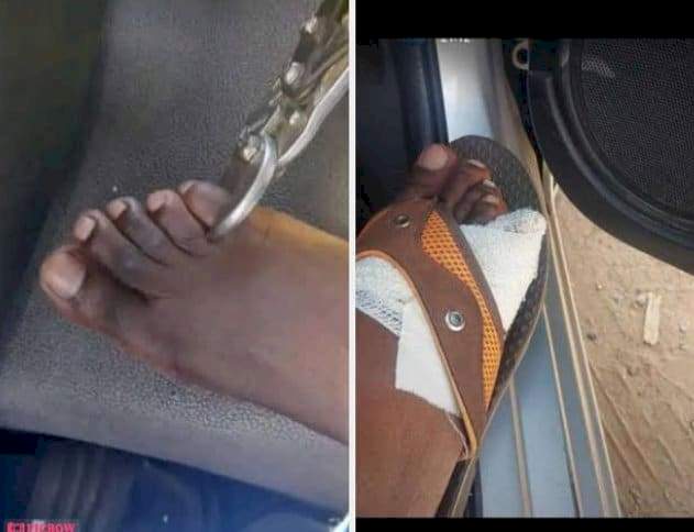 Rising cost of living allegedly forcing Zimbabwean citizens to cut and sell off their toes [Photos/Video]