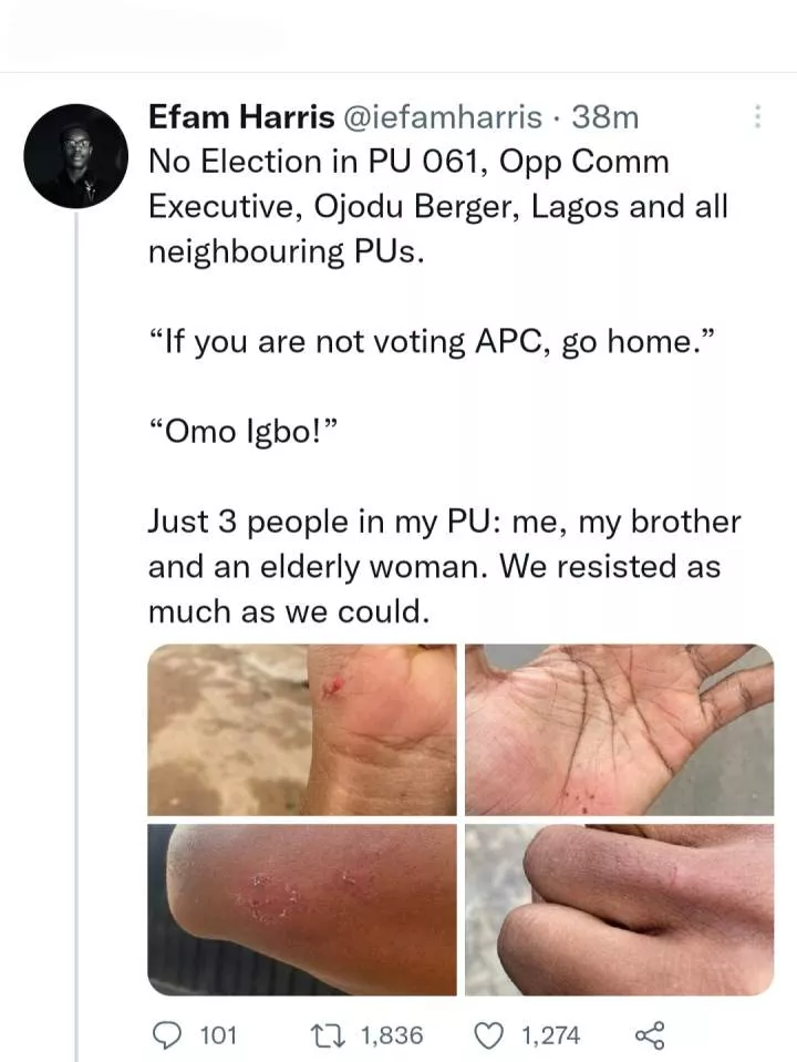 Man called 'omo Igbo' and injured by thugs who warned those not voting APC to go home in Ojodu Berger