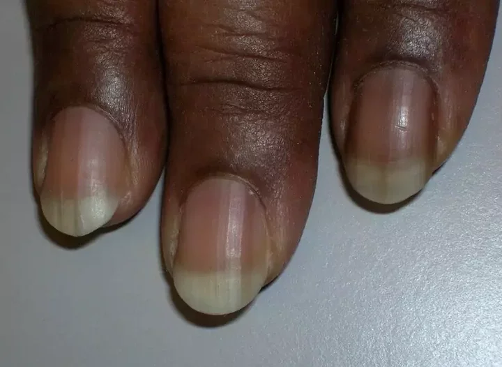 Here's what your fingernails reveal about the state of your health