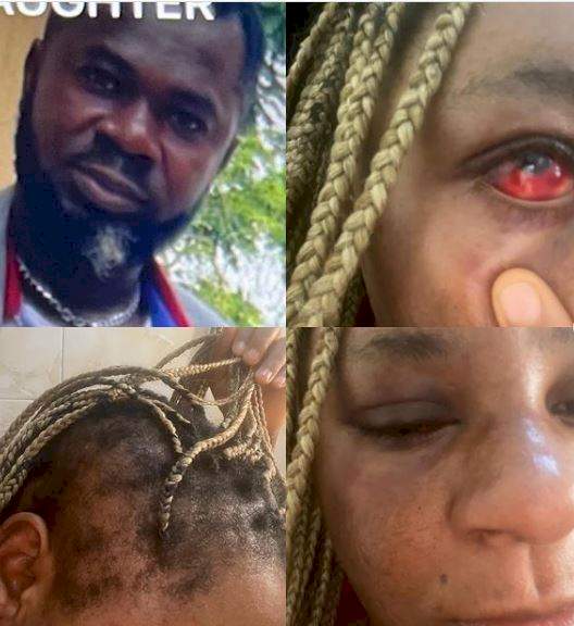 Rapper, Speed Darlington cries out after his sister was physically abused by her husband