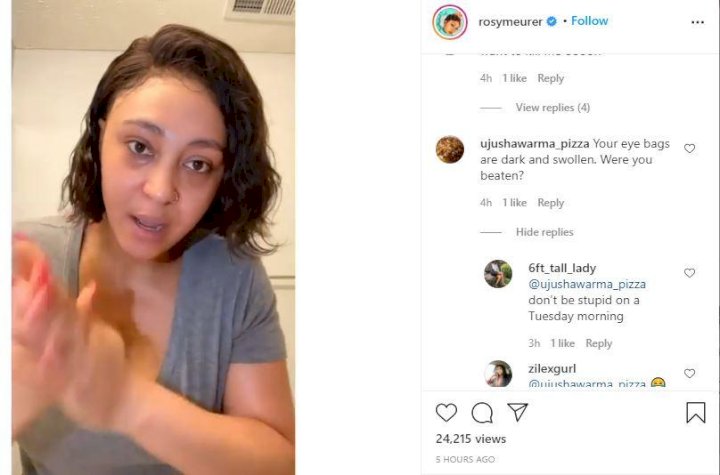 “Were you beaten?” – Fans express concern over Rosy Meurer’s looks in recent video