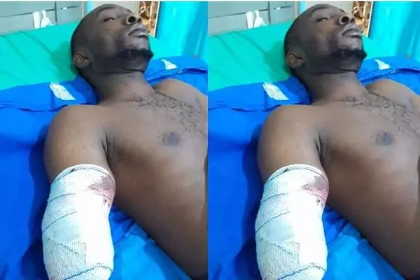 Factory machine cuts off worker's hand in Ogun