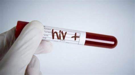 Fourth person cured of HIV