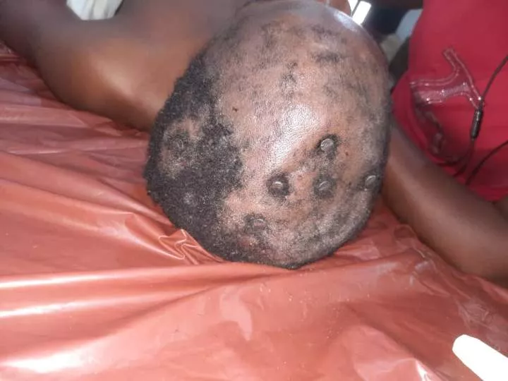 Graphic photos of unconscious man found with several nails driven into his skull