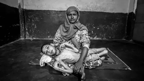 Getty Images BHOPAL, INDIA: Sameer Hasan, 16 years old, with his mother Wahida Bee at home. Sameer was born to parents contaminated by a carcinogenic and mutagenic water supply. This year marks the 31st anniversary of the 1984 Union Carbide gas tragedy that killed thousands of citizens of Bhopal within 72 hours and has gone on to claim thousands more as a result of the polluted environment. (Photo by Giles Clarke/Getty Images)