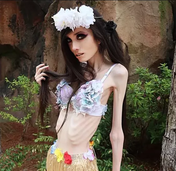 YouTuber Eugenia Cooney's skinny appearance spark concern as many call 911 to report