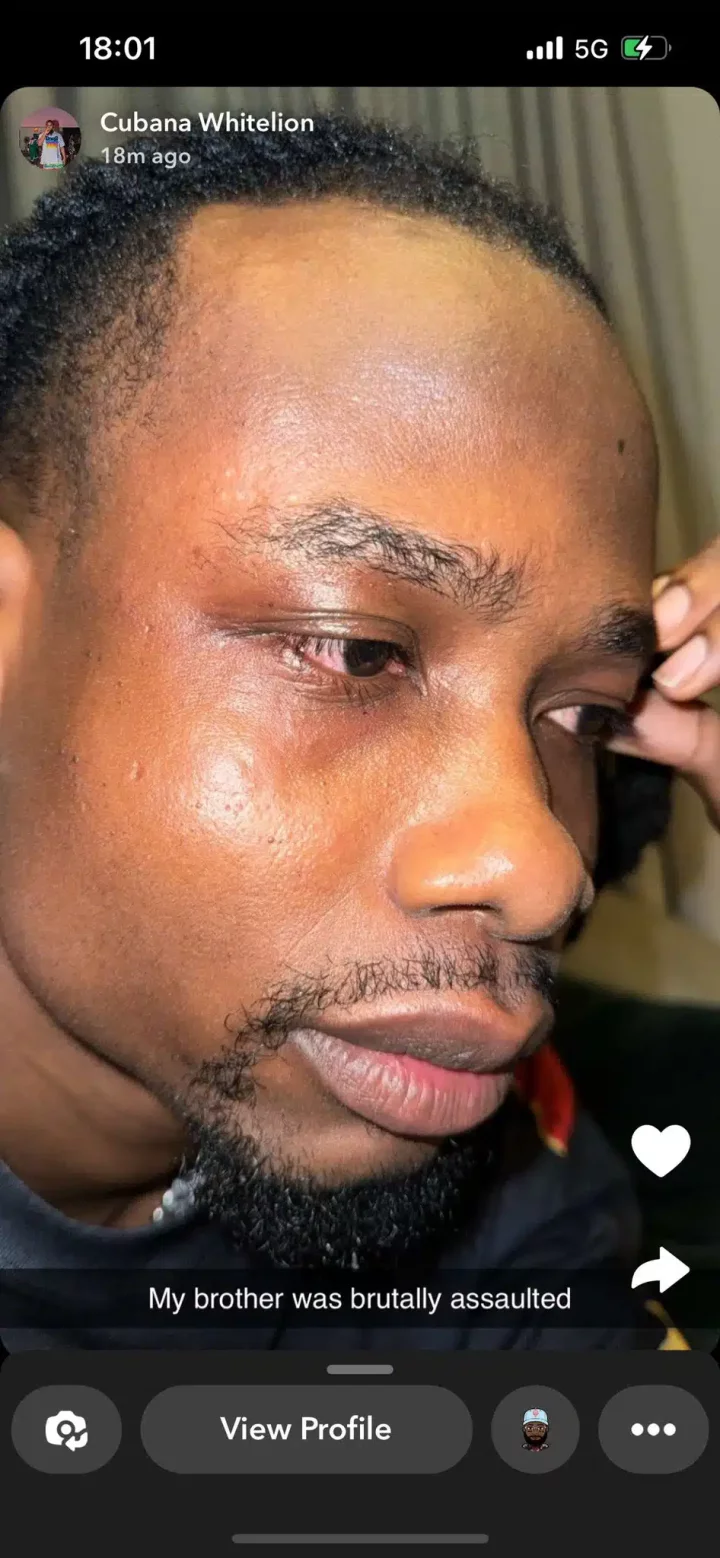 'He was assaulted by cultists' - Yhemolee's best friend speaks on what transpired