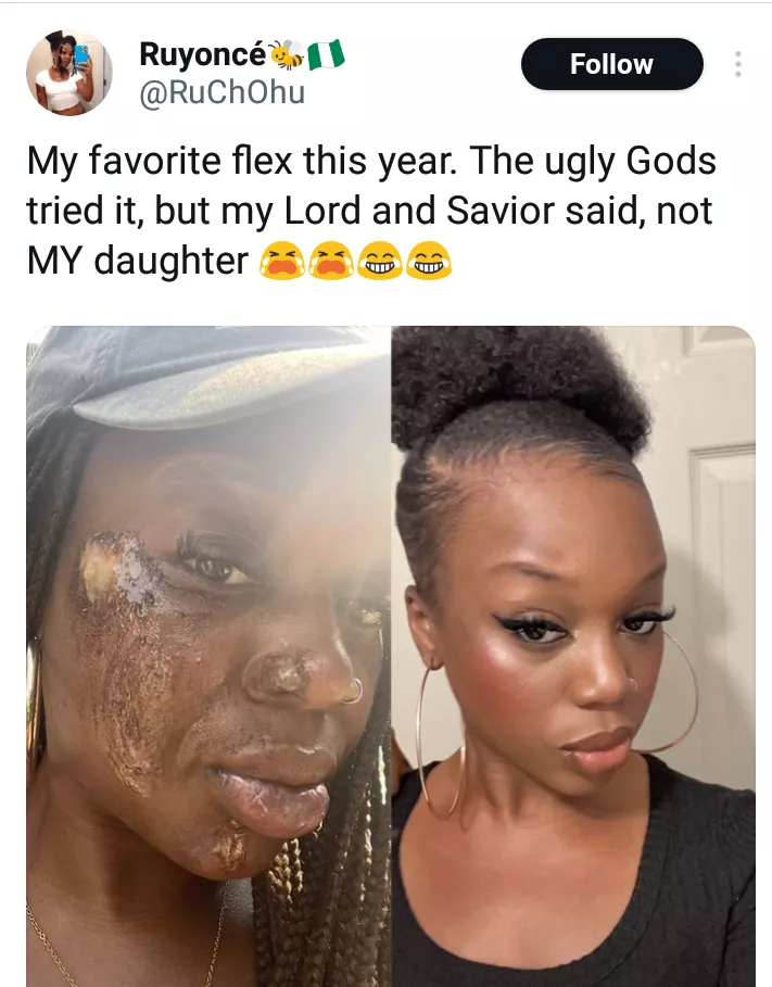 Nigerian lady shares photo of her healed face after surviving car accident