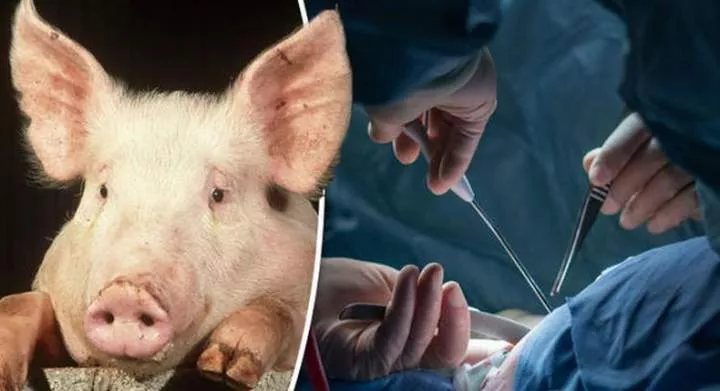 Man gets a new kidney from a pig in groundbreaking surgery