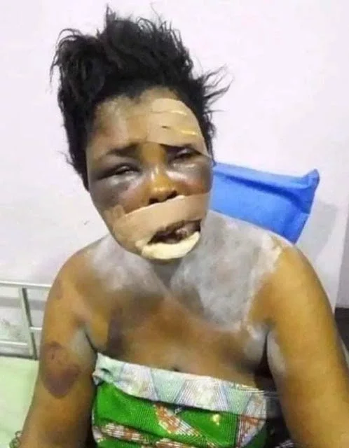 "How My Yahoo Son Tried to Remove My Eyes for Money Ritual"- Mother Narrates Ordeal