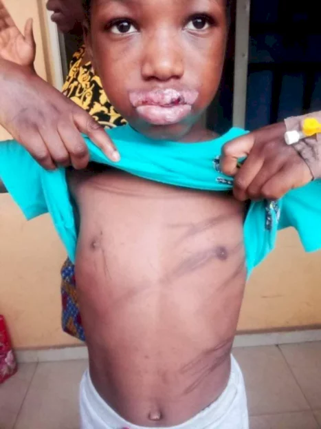Police arrests woman accused of dousing 10-year-old maid with hot water mixed with pepper for breaking a plate (graphic photos)