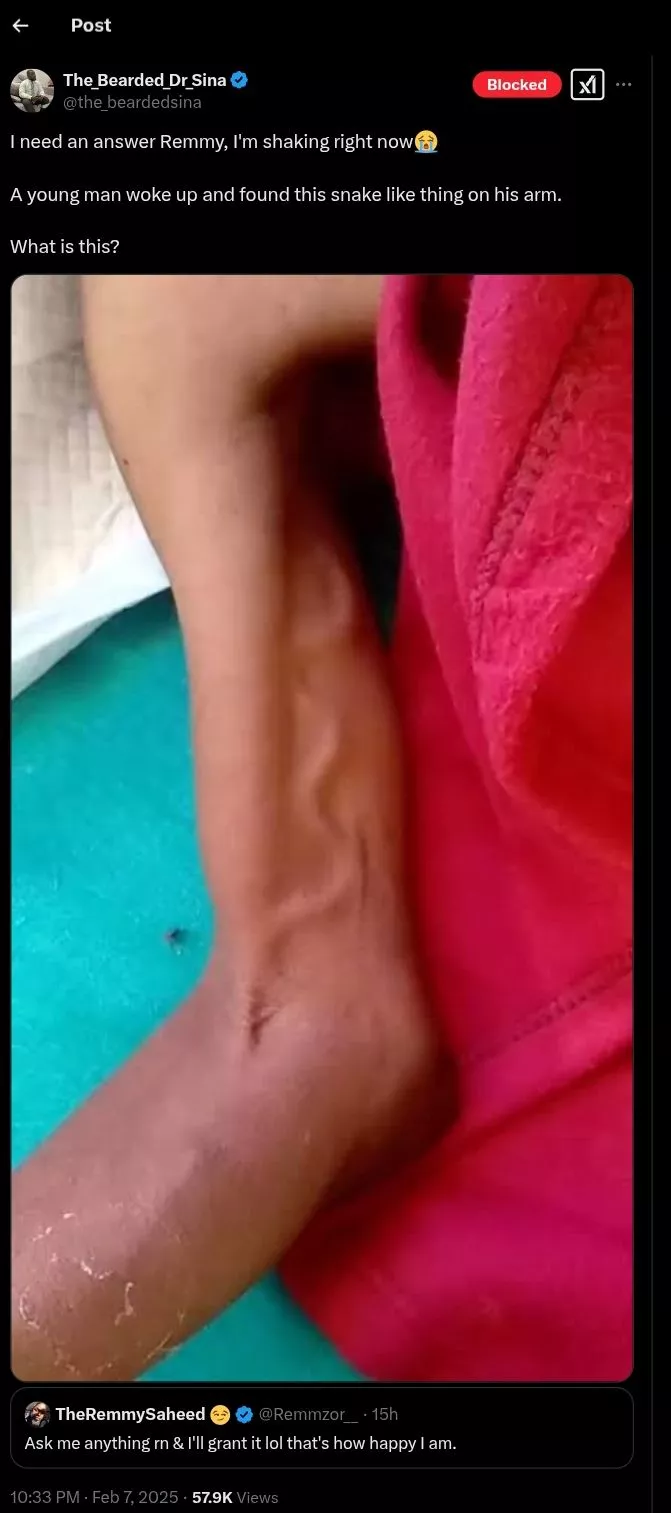 Man wakes up to mysterious snake-like mark on his arm