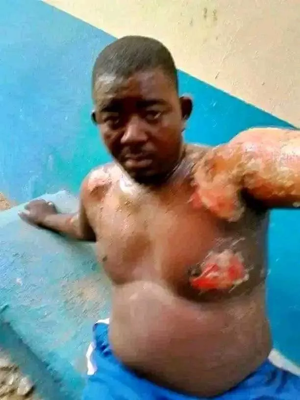 Woman pours hot water on her husband in Niger State