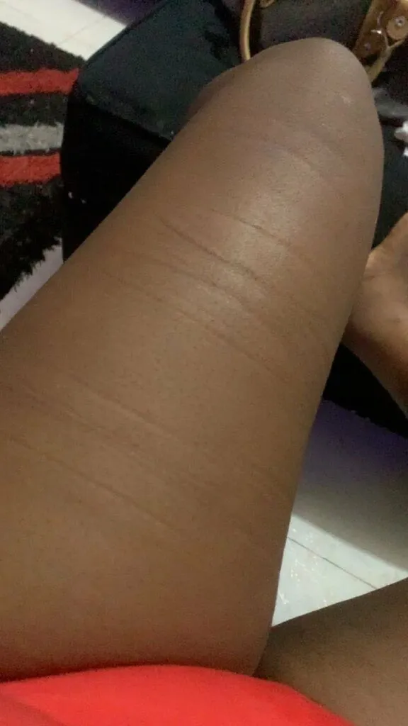 Husband beats wife with cane, gives her STD that led to miscarriage, friend speaks out