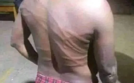 BEDC Officials Get Ass@ulted During Revenue Collection