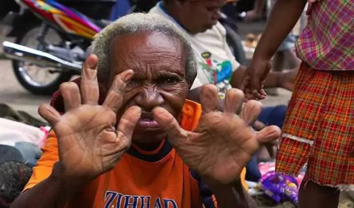 See the tribe where women cut off their fingers when a loved one dies