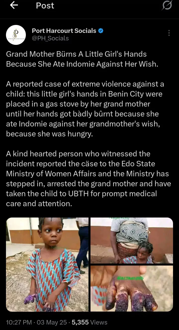 Grandmother arrested for burning granddaughter's hands after she ate Indomie