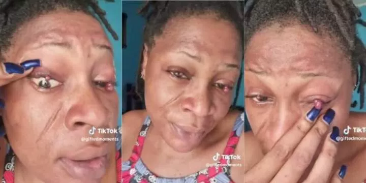 "It's becoming scary" - Lady shares how pregnancy affected her eyes