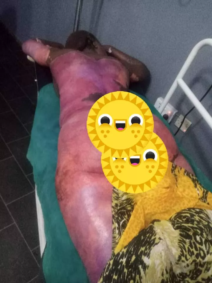 Nigerian lady dies after friends allegedly pushed her into pot of boiling fresh pepper and tomatoes (graphic photo)