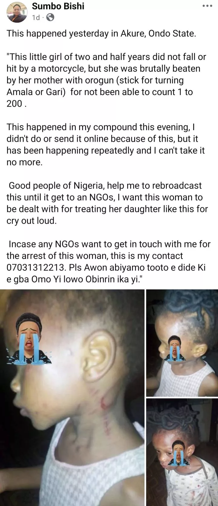 Girl left with welts after her mother allegedly b3,at her for not knowing how to count in Ondo state (photos)