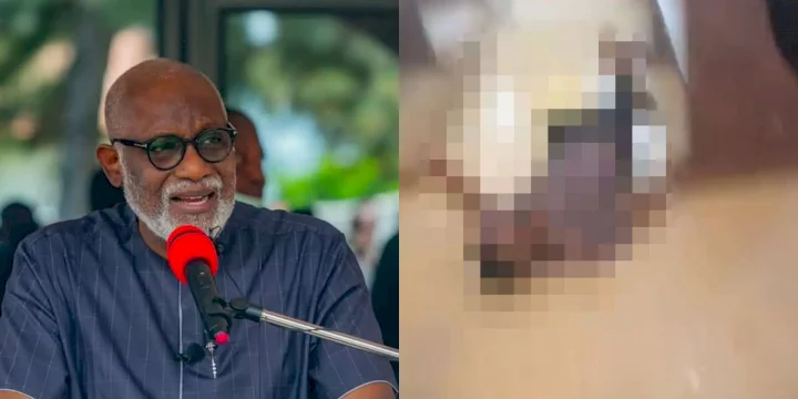Black Sunday: Gov. Akeredolu reacts as unknown gunmen invade a church in Ondo; kill scores of worshippers (Video)