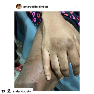 How God kept my baby alive in my womb for 8hrs after I almost d#ed on the way to the hospital - Actress Amarachi Igidimbah