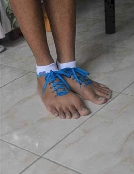"How will I be wearing somebody's leg inside my leg?" - Reactions as shoes which look like human feet surfaces online