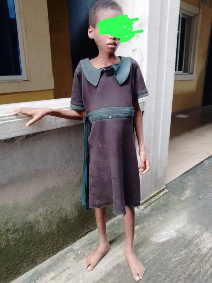 Akwa Ibom NSCDC rescues 12-year-old girl locked up, st@rved and t0rtured for two years by her father and stepmother over witchcraft allegation