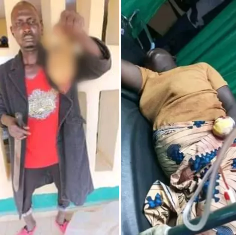 Man allegedly chops off his wife's hand over N3000 in Jos (Photos)