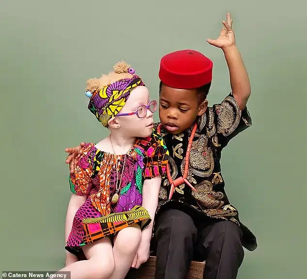 'People don't believe they are twins' - Nigerian mum flaunts albino daughter and her dark-skinned brother (Photos)